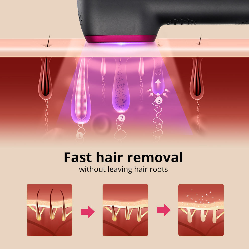 Painless Laser Hair Removal - EverActive Fitness